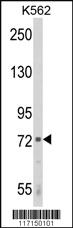 Anti-ALOX12 Rabbit Polyclonal Antibody