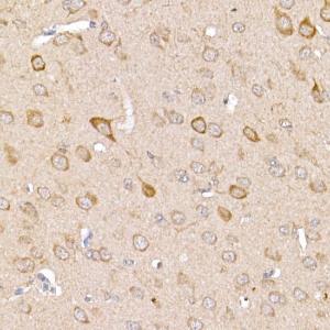 Immunohistochemistry analysis of paraffin-embedded mouse brain using Anti-TRAF2 Antibody (A12723) at a dilution of 1:200 (40x lens). Perform high pressure antigen retrieval with 10 mM citrate buffer pH 6.0 before commencing with IHC staining protocol.