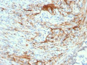 Immunohistochemical analysis of formalin-fixed, paraffin-embedded human small intestine using Anti-Elastin Antibody [ELN/3131R]