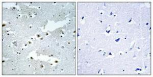 Immunohistochemical analysis of paraffin-embedded human brain using Anti-CDC40 Antibody 1:100 (4°C overnight). The right hand panel represents a negative control, where the antibody was pre-incubated with the immunising peptide.