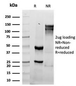 SDS-PAGE analysis of Anti-Granzyme B Antibody [rGZMB/4538] under non-reduced and reduced conditions; showing intact IgG and intact heavy and light chains, respectively. SDS-PAGE analysis confirms the integrity and purity of the antibody