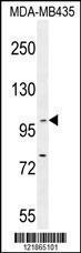 Anti-BACH2 Rabbit Polyclonal Antibody (AP (Alkaline Phosphatase))