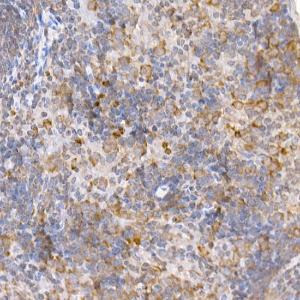 Immunohistochemistry analysis of paraffin-embedded mouse spleen using Anti-TRAF2 Antibody (A12723) at a dilution of 1:200 (40x lens). Perform high pressure antigen retrieval with 10 mM citrate buffer pH 6.0 before commencing with IHC staining protocol.