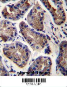 Anti-SLC9A2 Rabbit Polyclonal Antibody