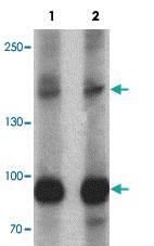 Anti-VPS13B Rabbit Polyclonal Antibody