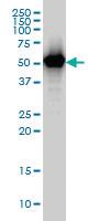 Anti-TAPBPL Mouse Monoclonal Antibody [clone: 6E3]