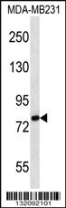 Anti-SLC9A2 Rabbit Polyclonal Antibody