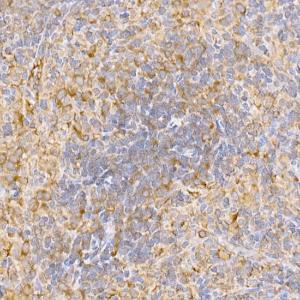 Immunohistochemistry analysis of paraffin-embedded rat spleen using Anti-TRAF2 Antibody (A12723) at a dilution of 1:200 (40x lens). Perform high pressure antigen retrieval with 10 mM citrate buffer pH 6.0 before commencing with IHC staining protocol.