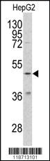 Anti-ARHGDIB Rabbit Polyclonal Antibody