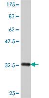 Anti-PIGM Mouse Polyclonal Antibody