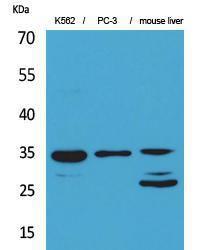 Western blot analysis of K56 PC 3, mouse liver cells using Anti-CDC34 Antibody