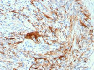 Immunohistochemical analysis of formalin-fixed, paraffin-embedded human small intestine using Anti-Elastin Antibody [ELN/3131R]