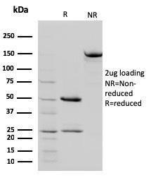 SDS-PAGE analysis of Anti-STAT5B Antibody [STAT5B/2657] under non-reduced and reduced conditions; showing intact IgG and intact heavy and light chains, respectively. SDS-PAGE analysis confirms the integrity and purity of the antibody