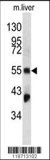 Anti-FGG Rabbit Polyclonal Antibody