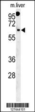 Anti-RTKN2 Rabbit Polyclonal Antibody