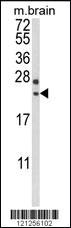 Anti-RGS4 Rabbit Polyclonal Antibody