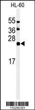 Anti-ISG15 Rabbit Polyclonal Antibody (PE (Phycoerythrin))