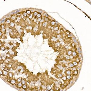 Immunohistochemistry analysis of paraffin-embedded rat testis using Anti-TRAF2 Antibody (A12723) at a dilution of 1:200 (40x lens). Perform high pressure antigen retrieval with 10 mM citrate buffer pH 6.0 before commencing with IHC staining protocol.