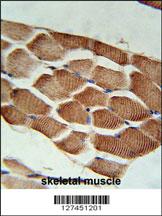 Anti-ARHGEF3 Rabbit Polyclonal Antibody