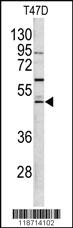 Anti-FGG Rabbit Polyclonal Antibody