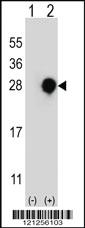 Anti-RGS4 Rabbit Polyclonal Antibody