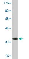 Anti-SSTR1 Mouse Monoclonal Antibody [clone: 1F7]