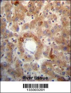 Anti-PTEN Rabbit Polyclonal Antibody (FITC (Fluorescein Isothiocyanate))