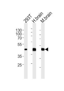 Anti-STRADA Rabbit Polyclonal Antibody