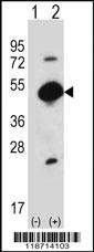 Anti-FGG Rabbit Polyclonal Antibody