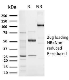 SDS-PAGE analysis of Anti-Elastin Antibody [ELN/3131R] under non-reduced and reduced conditions; showing intact IgG and intact heavy and light chains, respectively. SDS-PAGE analysis confirms the integrity and purity of the antibody.