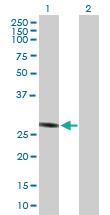 Anti-PGLS Mouse Polyclonal Antibody