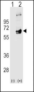 Anti-FYN Rabbit Polyclonal Antibody (PE (Phycoerythrin))