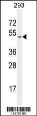 Anti-CHRDL1 Rabbit Polyclonal Antibody (APC (Allophycocyanin))