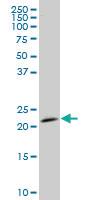 Anti-STMN2 Mouse Monoclonal Antibody [clone: 2G11]