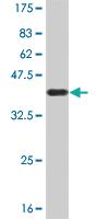 Anti-EP300 Mouse Monoclonal Antibody [clone: 1D2]