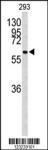 Anti-CDC73 Rabbit Polyclonal Antibody (FITC (Fluorescein Isothiocyanate))