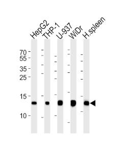 Anti-LYZ Rabbit Polyclonal Antibody