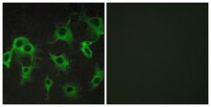 Immunofluorescence analysis of COS7 cells using Anti-ADRB2 Antibody The right hand panel represents a negative control, where the antibody was pre-incubated with the immunising peptide