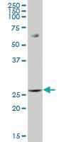 Anti-PGLS Mouse Polyclonal Antibody