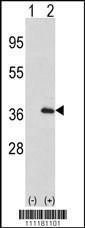 Anti-IL1A Rabbit Polyclonal Antibody (HRP (Horseradish Peroxidase))