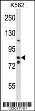 Anti-BACH2 Rabbit Polyclonal Antibody (FITC (Fluorescein Isothiocyanate))