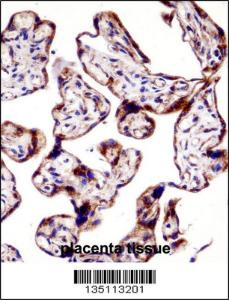 Anti-TEAD3 Rabbit Polyclonal Antibody (AP (Alkaline Phosphatase))