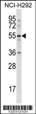 Anti-CLEC18A Rabbit Polyclonal Antibody