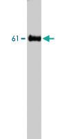 Anti-ADA2 Rabbit Polyclonal Antibody