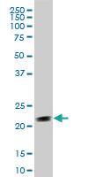 Anti-STMN2 Mouse Monoclonal Antibody [clone: 2G7]