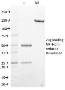 SDS-PAGE analysis of Anti-STAT6 Antibody [STAT6/2410] under non-reduced and reduced conditions; showing intact IgG and intact heavy and light chains, respectively. SDS-PAGE analysis confirms the integrity and purity of the antibody