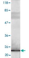 Anti-Flag tag Polyclonal Antibody