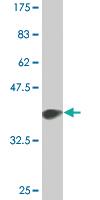 Anti-EP300 Mouse Monoclonal Antibody [clone: 1D2]