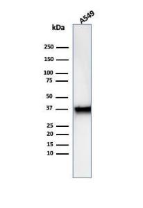 Western blot analysis of A549 cell line lysate using Anti-Annexin A1 Antibody [rANXA1/6451]