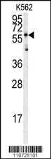 Anti-HRG Rabbit Polyclonal Antibody